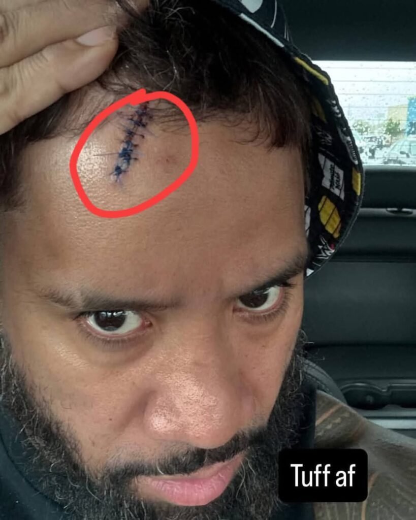 Main Event Jey Uso had to get stitches after accidently busting himself open at WrestlePalooza