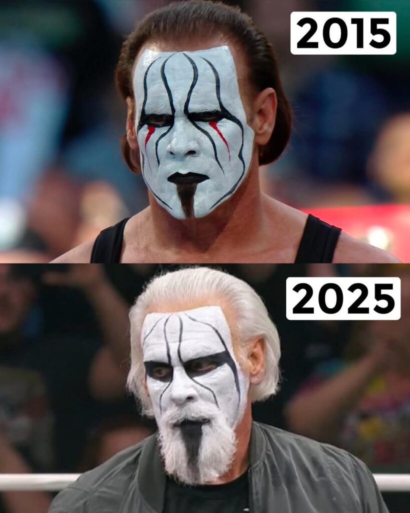 STING 10 years ago vs Today
