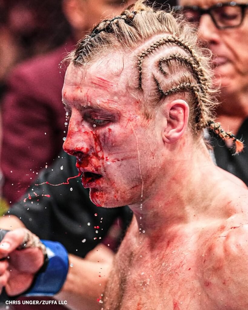 Scousers really don’t get knocked out 😱 #UFC324